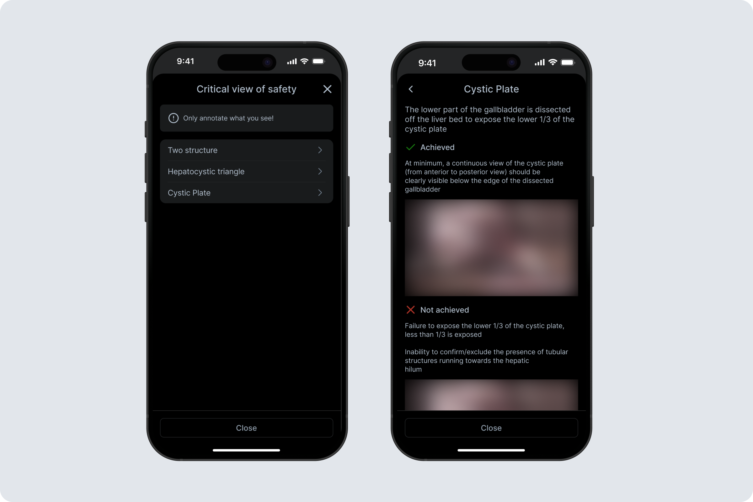 MVP v2: Image-first workflow